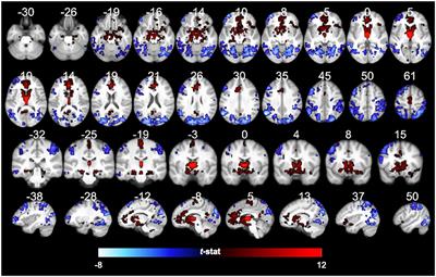 Corrigendum: Functional Connectivity of the Human Paraventricular Thalamic Nucleus: Insights From High Field Functional MRI